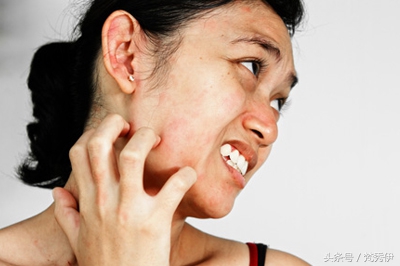 脸过敏发痒发红怎么护肤,脸感觉到刺痛怎么办