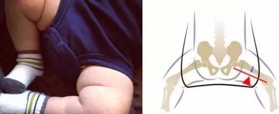 宝宝突然走路不稳o型腿,走路走不稳的宝宝