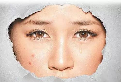 专门治痘痘的神器,抗痘痘最好的神器