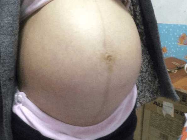 剖腹产妈妈的真实感受,剖腹产的真实感受