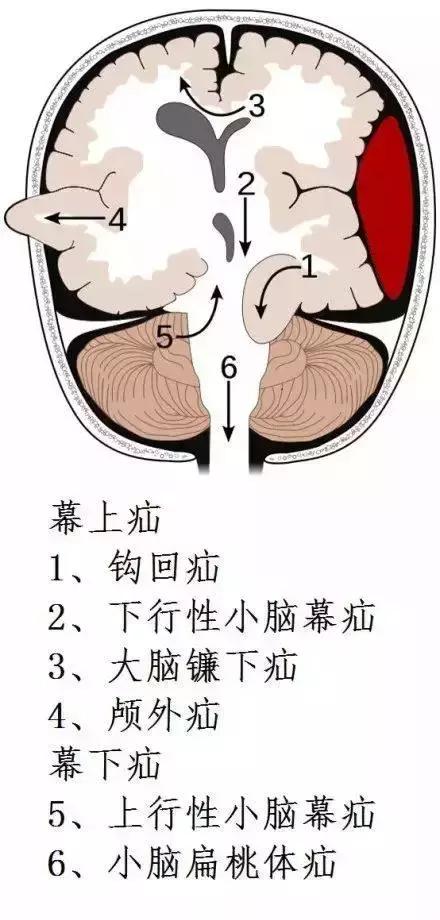 绘制神经系统的生理解剖图,人体骨骼血管神经系统解剖图