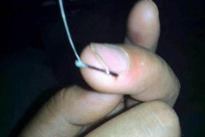 钓鱼怎么防止被钩到手,怎么钓鱼才不会被钩到呢