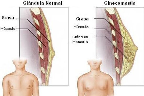 男性自测胸部有没有问题,男性胸越来越大是什么原因呢