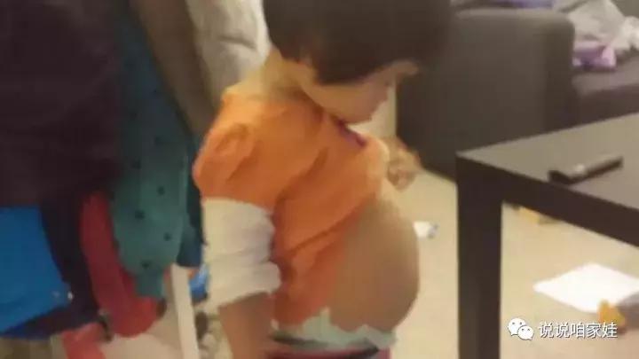 宝宝大肚腩怎么回事,宝宝胀气大肚子