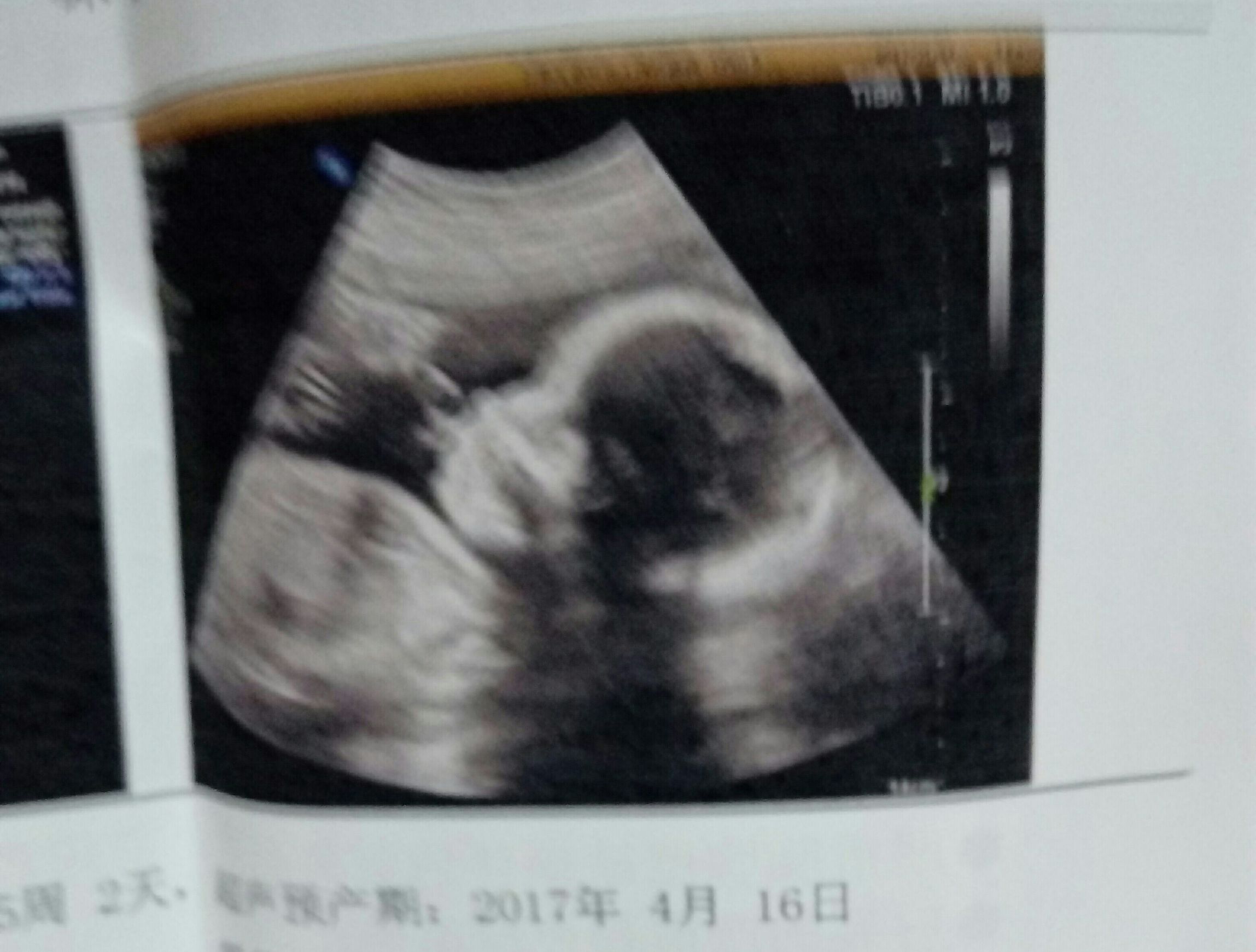 什么样的症状有可能怀孕，怀孕早期怎么缓解身体的不适