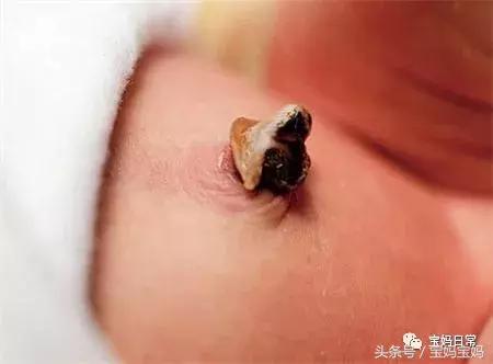 1-7天怎么护理新生儿脐带,新生儿宝妈催乳护理知识大全