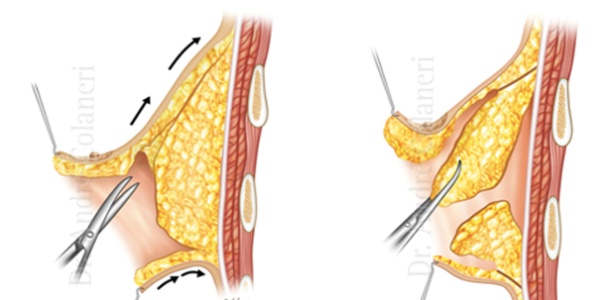 男性自测胸部有没有问题,男性胸越来越大是什么原因呢