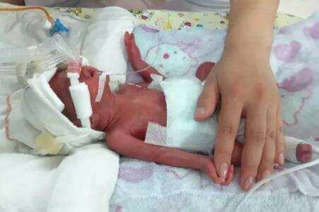 怀孕七八个月早产存活率,孕妈七个月早产视频