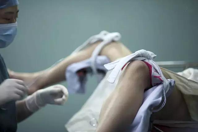 那些流产的婴儿都去哪里了,流产的婴儿一般怎么处理