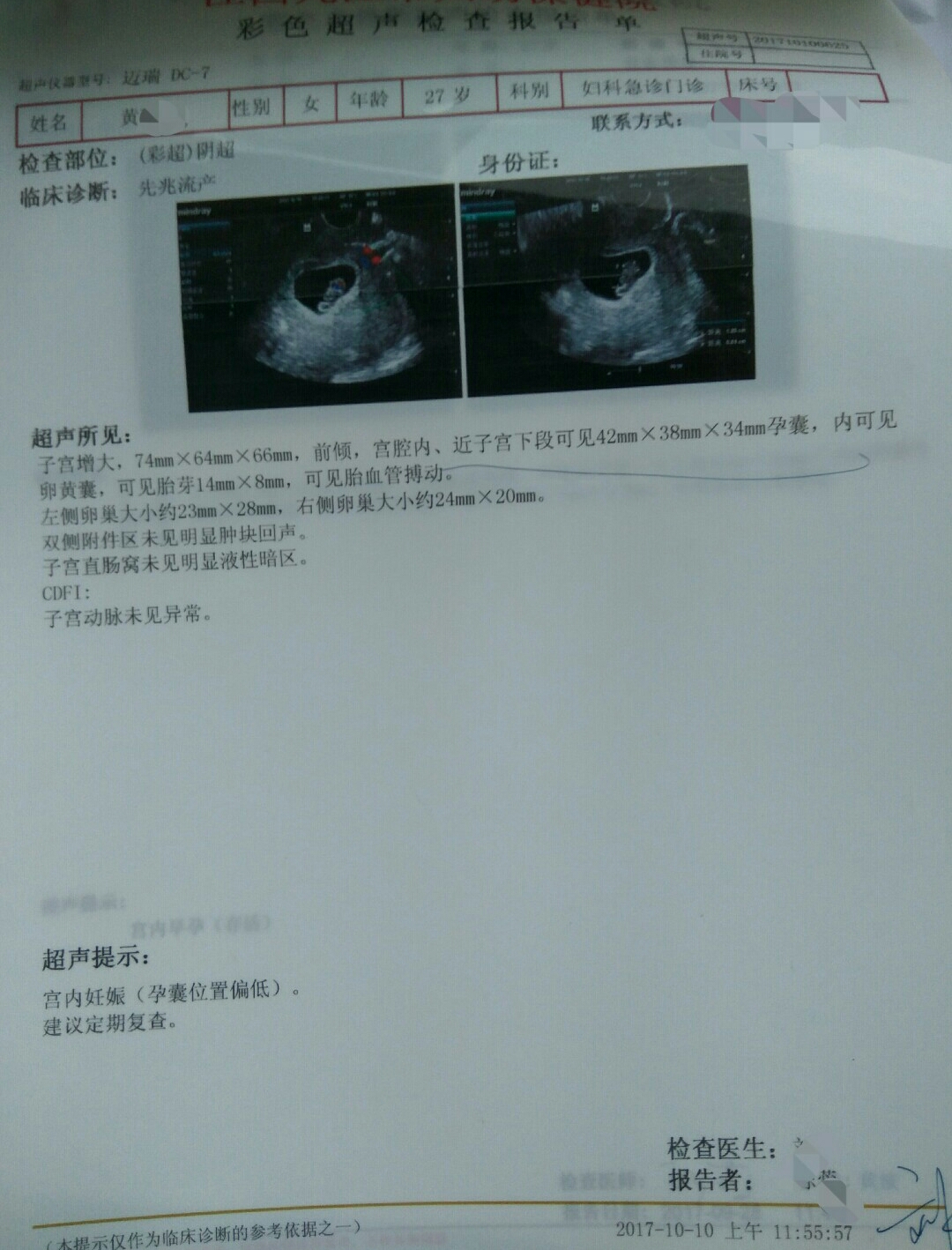 孕酮太低流血有保胎成功的吗,孕酮低保胎真实感受