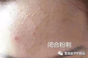 鑸掑┓鎶よ偆,鑸掑┓绁涚棙