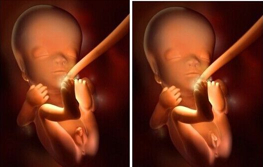 准妈妈必看孕期运动注意事项,孕期宝宝每天长多少算正常