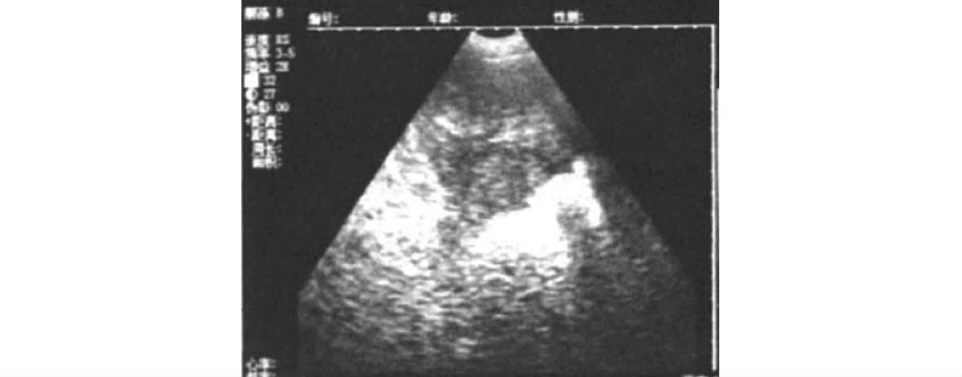 B超对猪场的生产中的应用