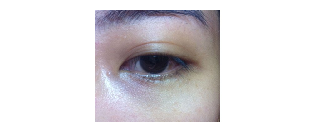 鱼子酱淡化泪沟眼袋黑眼圈眼霜,淡化黑眼圈眼袋泪沟哪个眼霜好