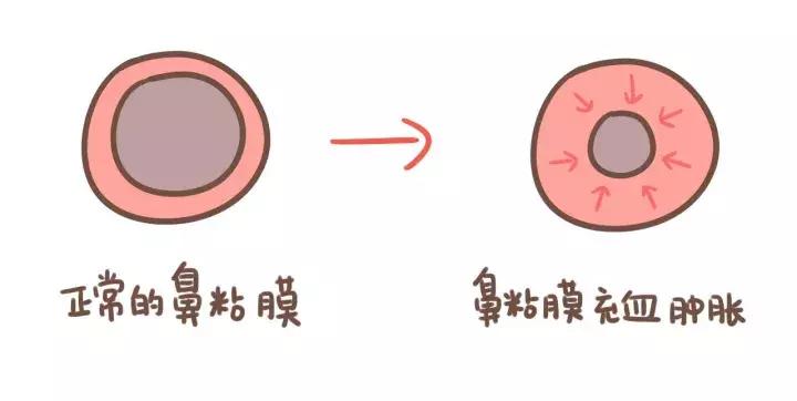 鼻炎漫画视频,过敏性鼻炎科普小视频漫画