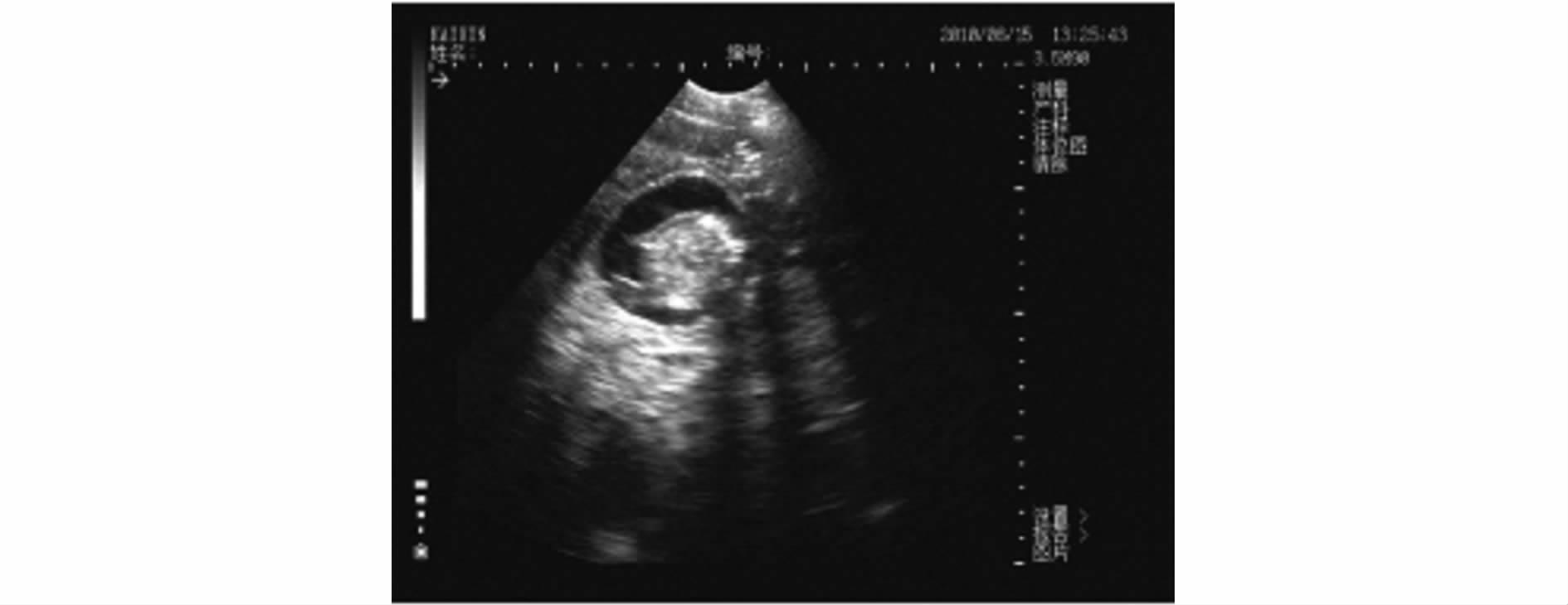 B超对猪场的生产中的应用