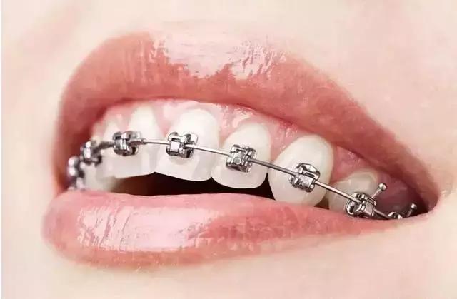 缺了一颗大牙牙齿缝隙越来越大,牙齿缝隙越来越大中医辨证