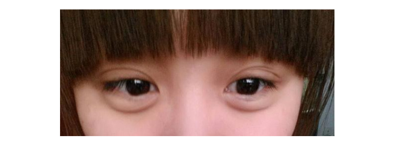 鱼子酱淡化泪沟眼袋黑眼圈眼霜,淡化黑眼圈眼袋泪沟哪个眼霜好