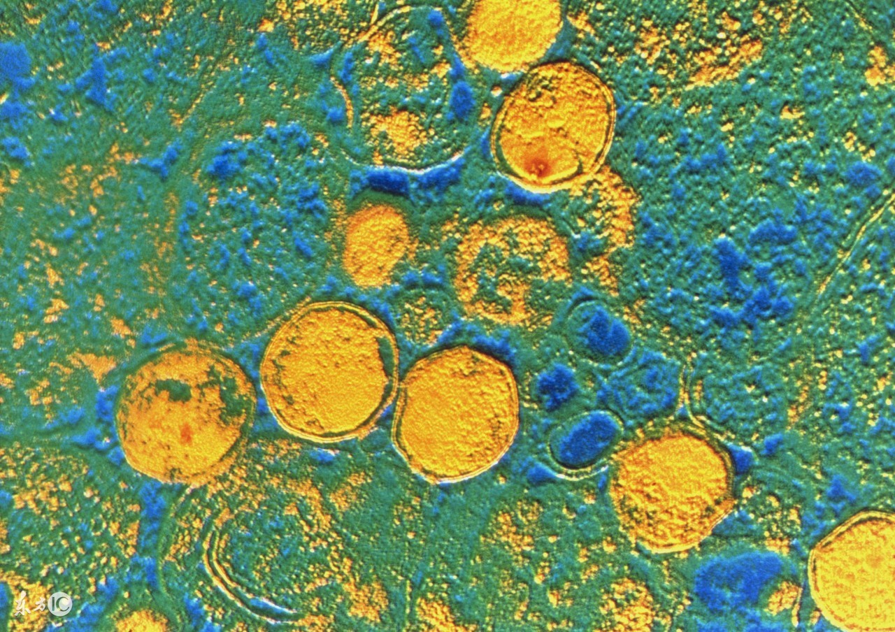 卫生巾最好不要用超过几个小时,使用卫生巾的这些误区