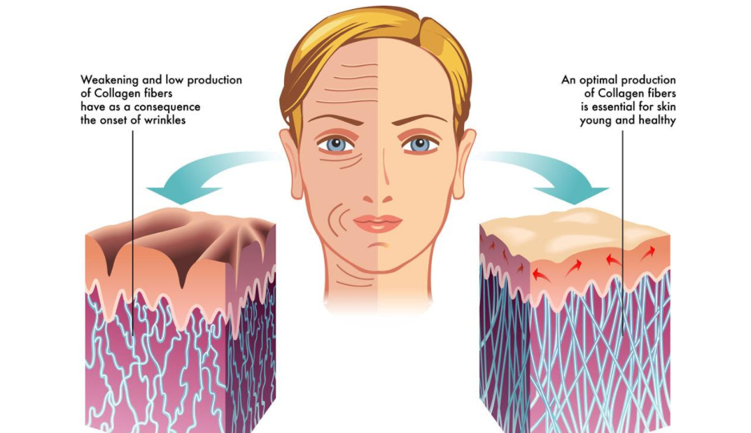 鱼子酱淡化泪沟眼袋黑眼圈眼霜,淡化黑眼圈眼袋泪沟哪个眼霜好