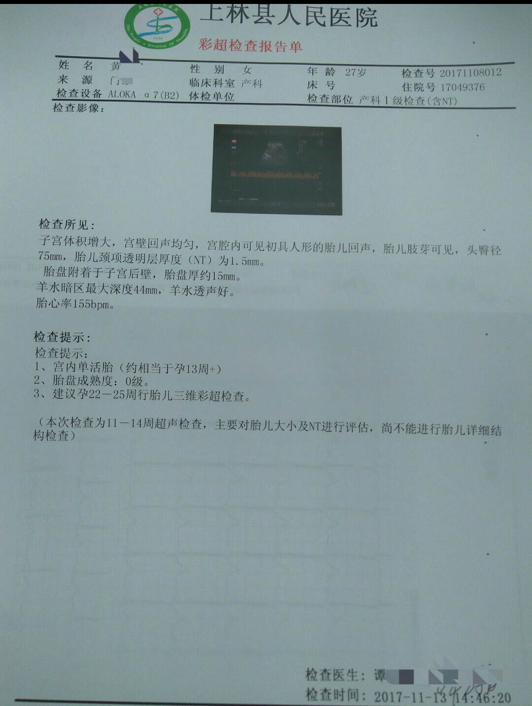 孕酮太低流血有保胎成功的吗,孕酮低保胎真实感受