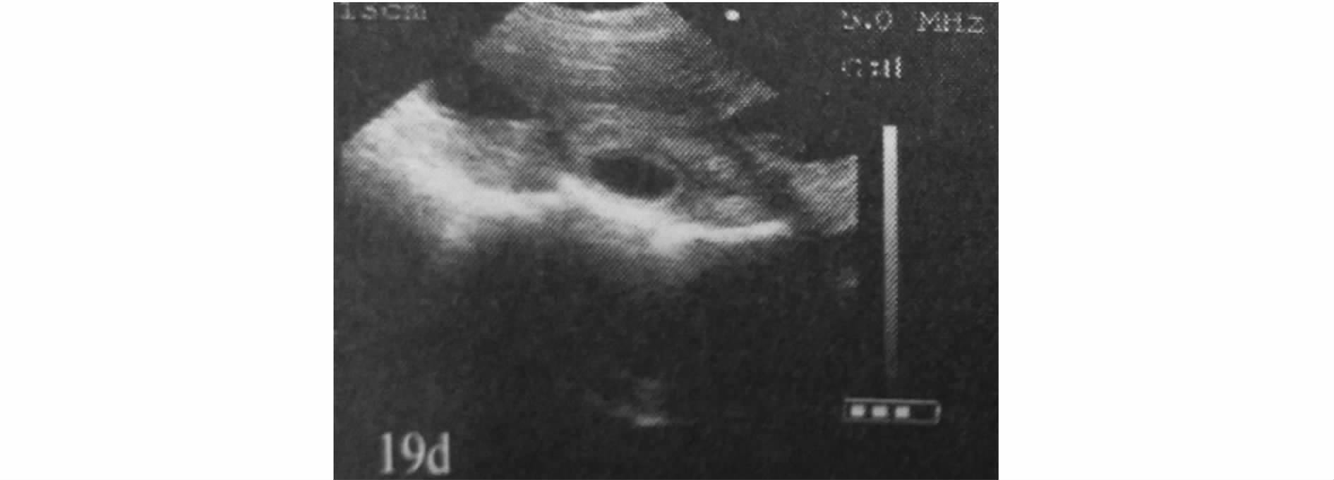 B超对猪场的生产中的应用
