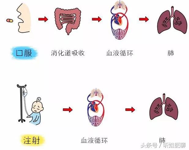 温度多变，儿童感冒咳嗽严重，家长是否要给孩子做雾化治疗呢？