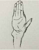 各类四肢骨折的常见病因,骨折体征知识点记忆口诀