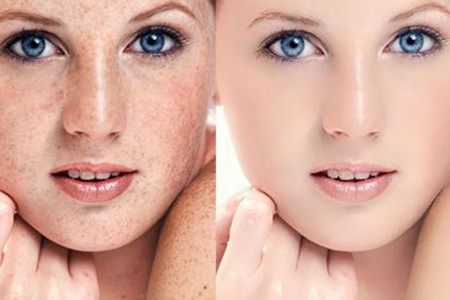 烟酰胺和氢醌霜哪个祛斑效果好,氢醌霜和壬二酸哪个祛斑效果更好