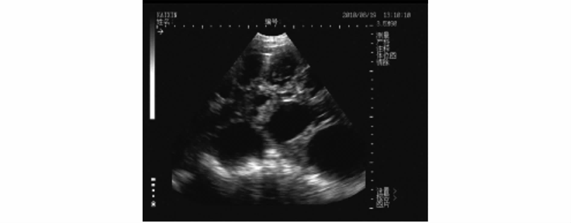 B超对猪场的生产中的应用