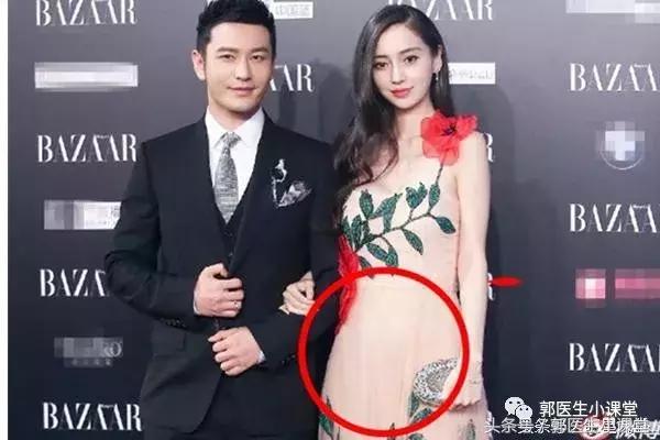 谢娜怀孕胖成球，有些人却瘦的被说是假怀孕