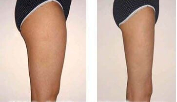 女性绝经几岁,大约40左右女性绝经正常吗