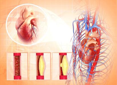 血压波动太大如何是好？改变一下吃药的习惯就可以解决