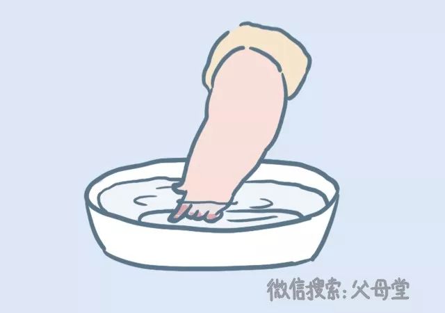 宝宝怎么防冻伤,宝宝烫伤天气热怎么护理