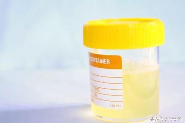 降蛋白尿的中草药有哪些,蛋白尿神药