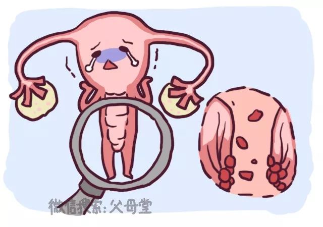 女生可怕的疾病,女性健康的十大杀手