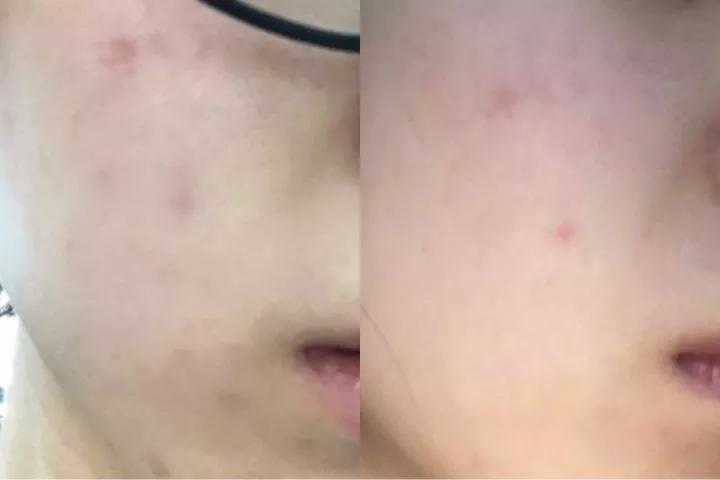 美白排行榜第一名真实测评,实测美白最强大的产品