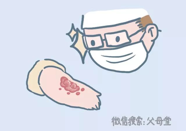 宝宝怎么防冻伤,宝宝烫伤天气热怎么护理