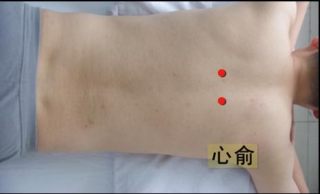 满满干货｜小小艾灸能量大，赶走酒瘾全靠它！