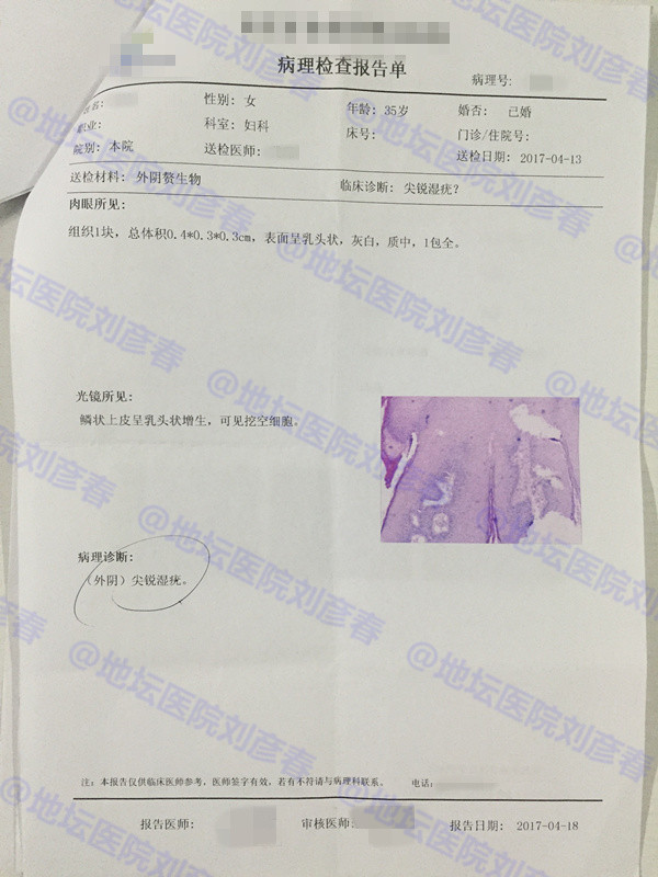 尖锐性湿疣报告阴性后还会传染吗,尖锐性湿疣会在医院病历记载吗