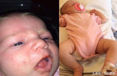 粉嫩婴儿心底有话，站远点别亲我，宝宝怕疱疹病毒