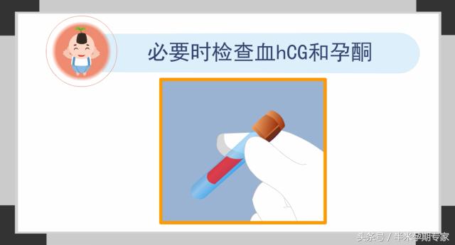 胚胎停育如何处理,人工流产胚胎