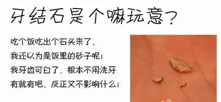 牙齿上长石头图片,你的牙齿还在吗