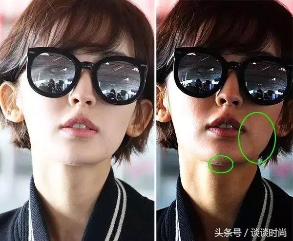 干货亲测最强去闭口攻略,亲身测评如何安全有效的去闭口