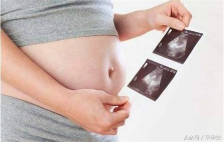 大排畸检查小孩不配合怎么办,大排畸检查胎儿不配合翻身怎么办