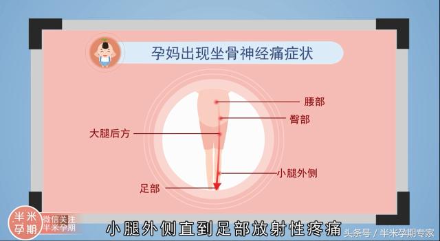 孕期腰酸背痛肚子痛，是怎么回事呢？