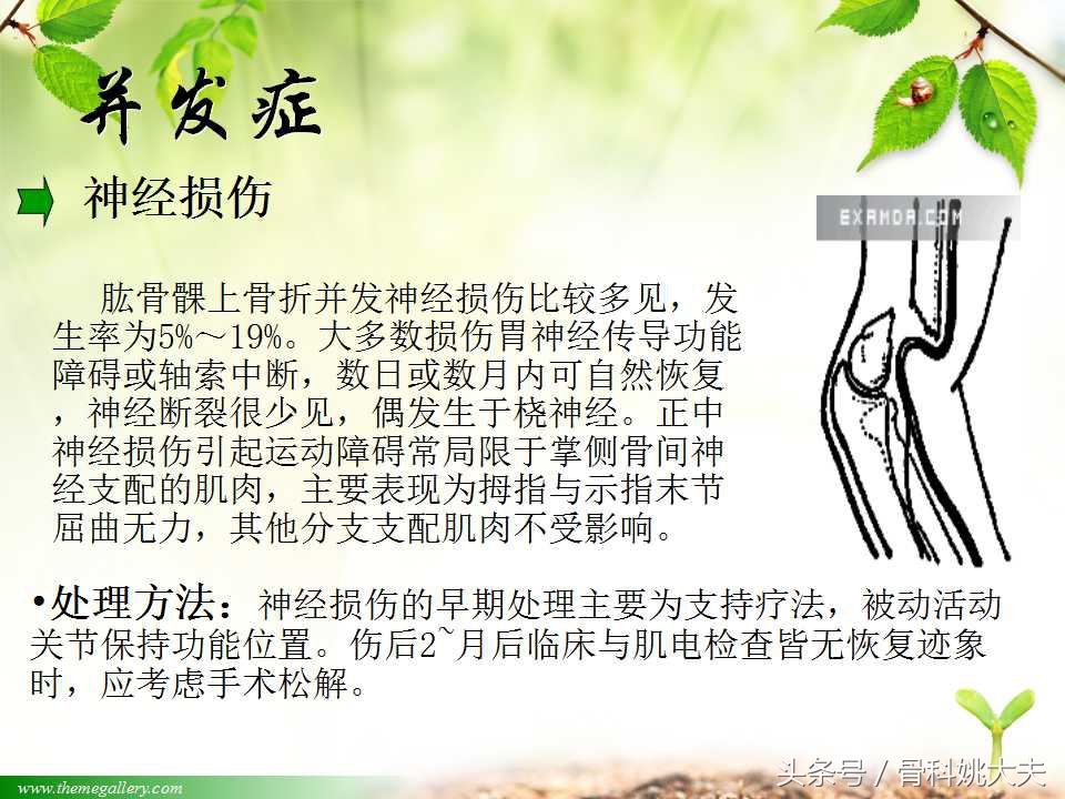 儿童肱骨干骨折处理方法,小孩胳膊肱骨骨折恢复最佳的方法