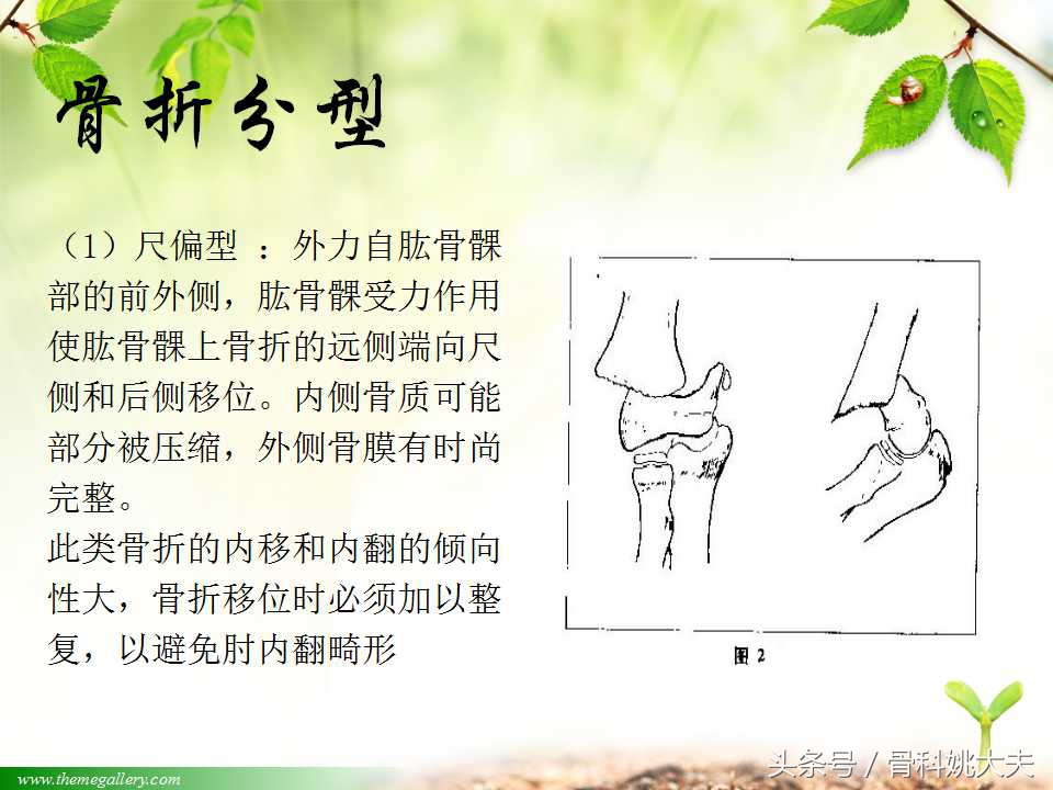 儿童肱骨干骨折处理方法,小孩胳膊肱骨骨折恢复最佳的方法