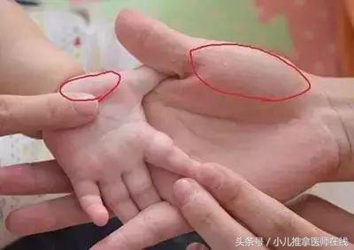 消化不好怎么推拿,宝宝消化不好怎么推拿