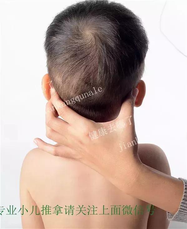 鼻炎小儿推拿手法,小儿鼻炎推拿常用手法